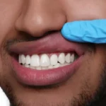 Gum Treatments for Enhanced Oral Health