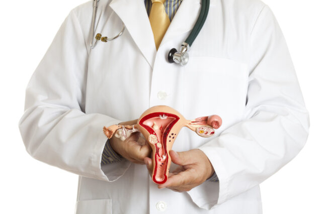managing fibroids