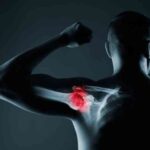 Importance of Shoulder Preservation