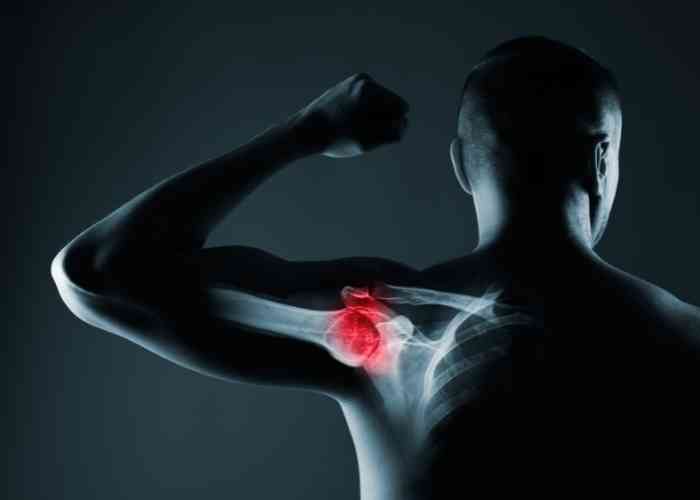 Importance of Shoulder Preservation